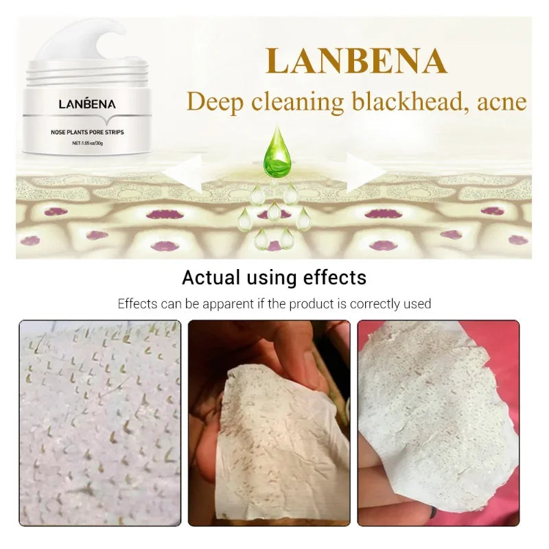 LANBENA Blackhead Remover Nose Mask Pore Strip Black Mask Peeling Acne Treatment Face Deep Cleansing Skin Care Korea Cosmetics